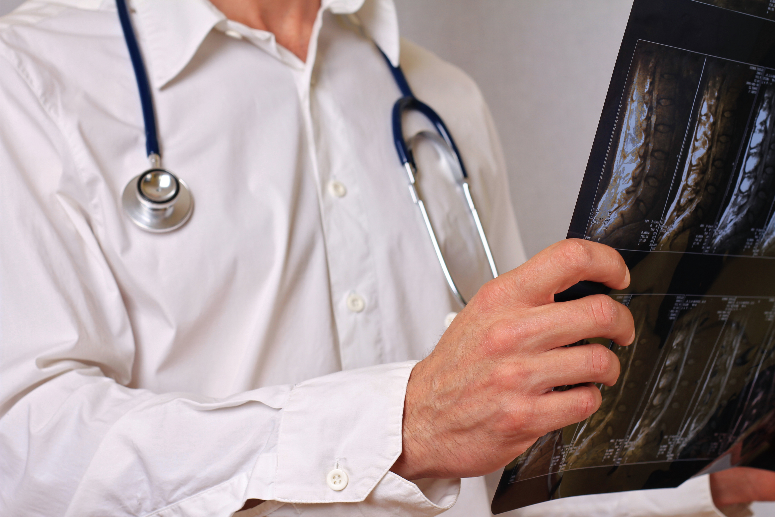 Doctor Holding X-ray