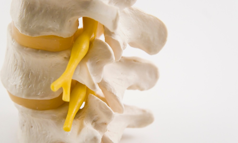 Life-After-Fusion-Back-Surgery