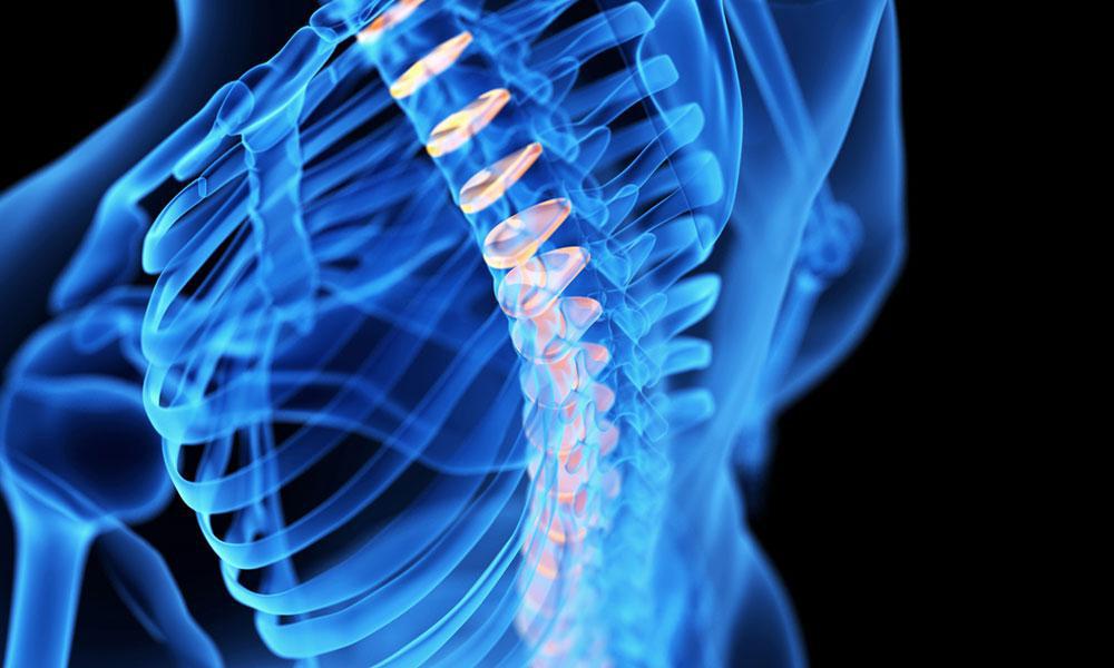 Spine X-ray